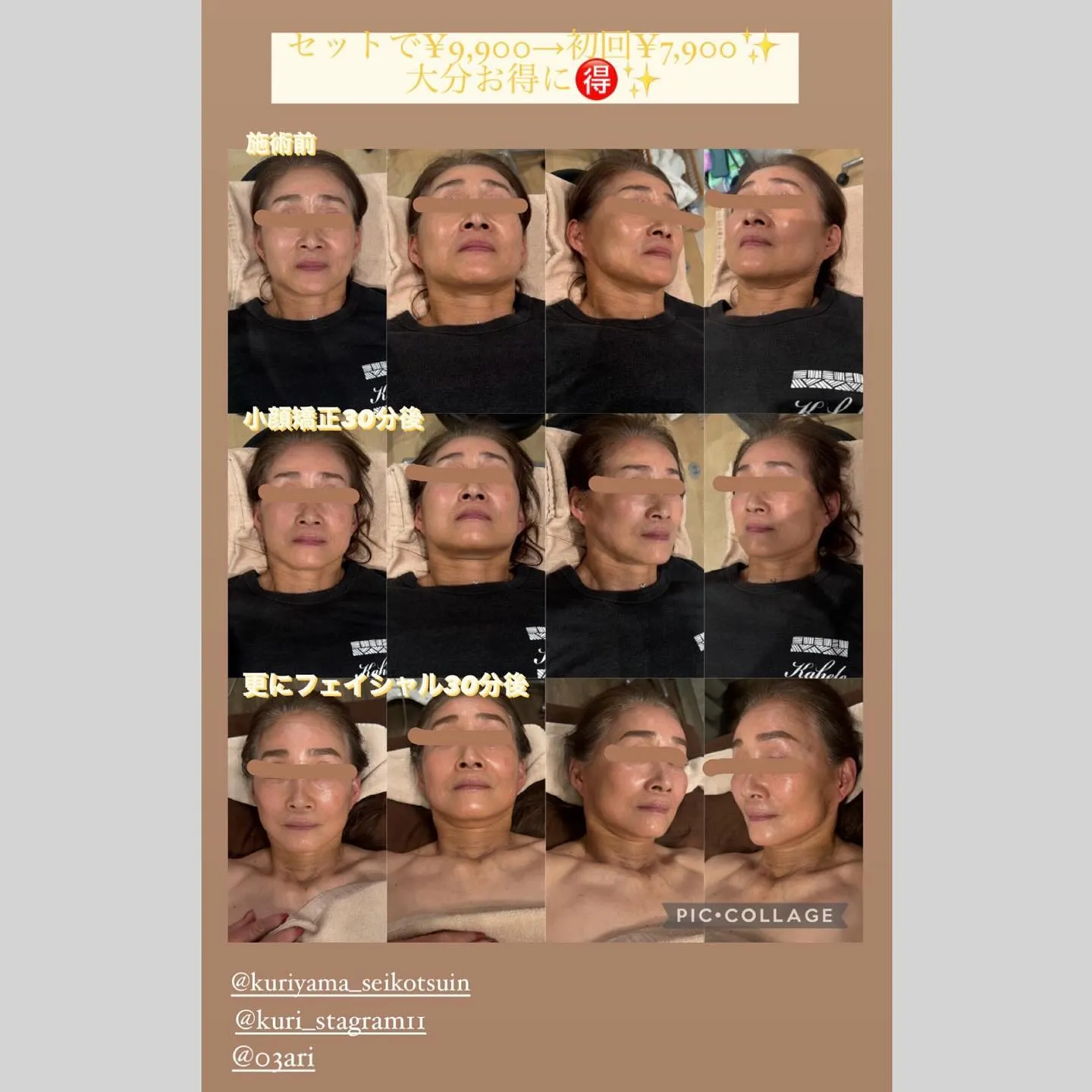 【西宮のエステと整骨院】小顔矯正とフェイシャル✨