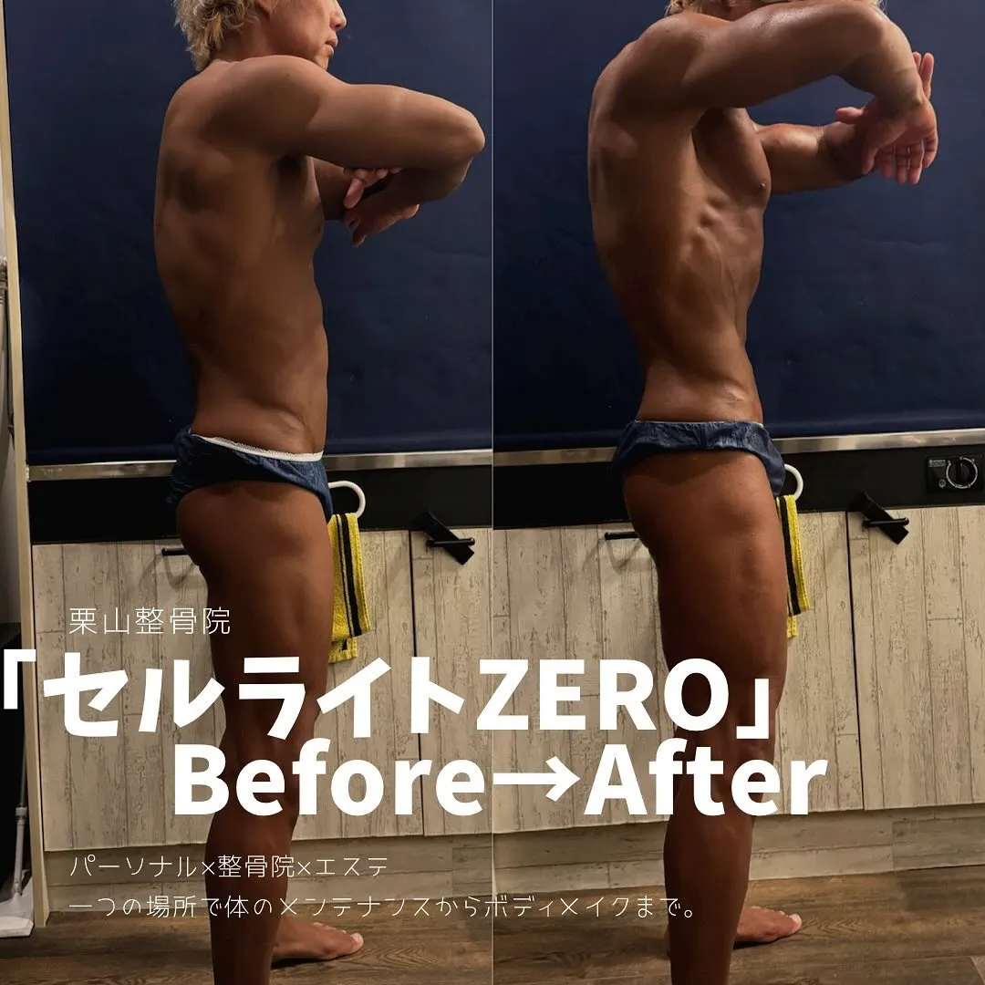  筋肉のカット出し＝極限まで体脂肪を減らし筋肉と皮膚だけの状態へと💪大会メダル獲得者輩出サロン！