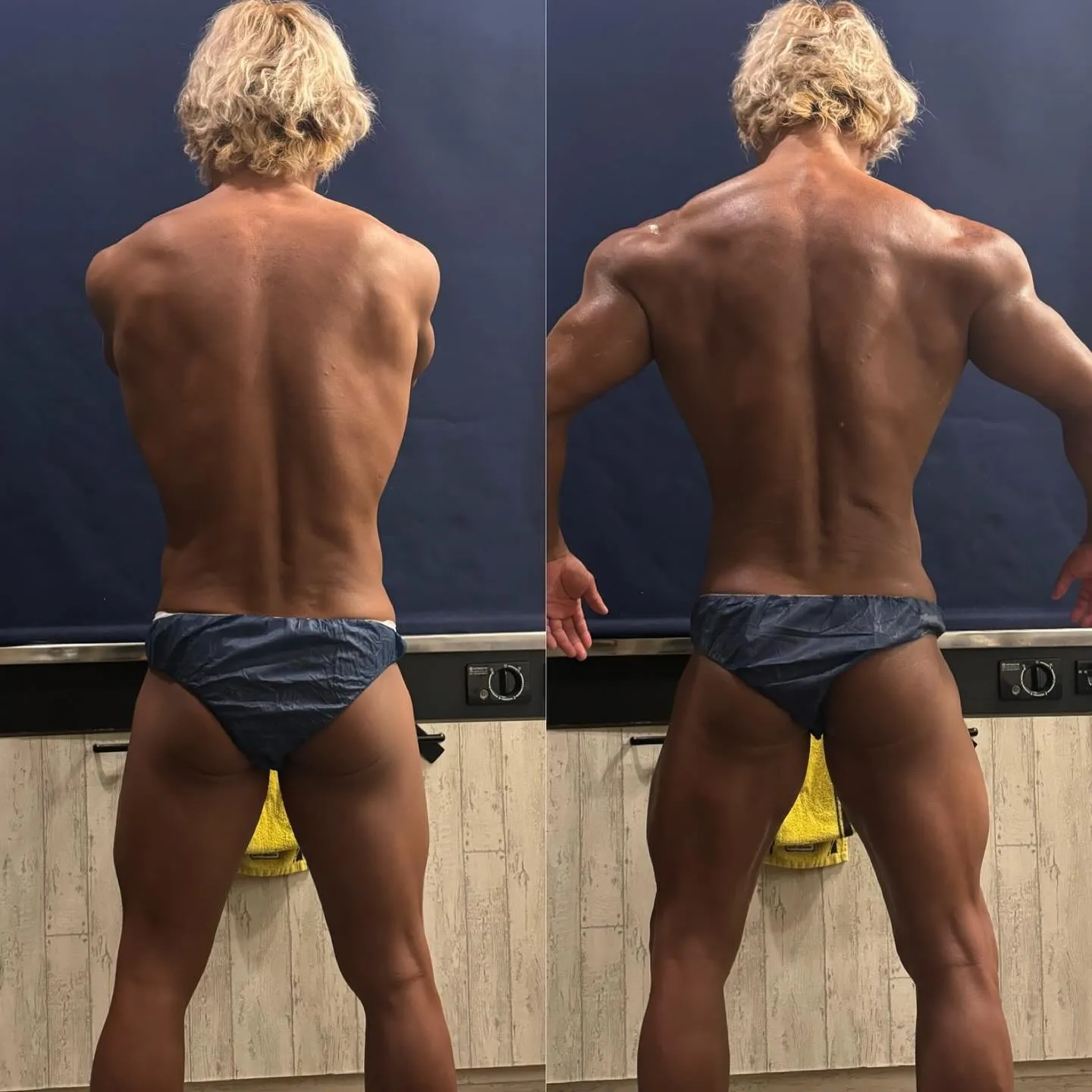 【セルゼロ】痩身に加え筋肉のカットを出したり出来るマシンです...