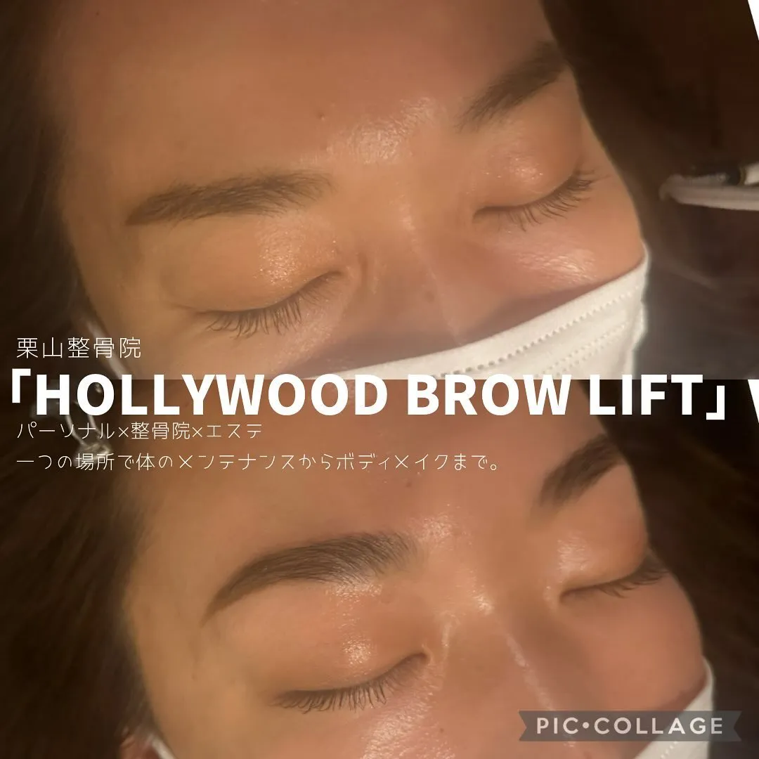 ハリウッドブロウリフト・HBLとは眉をどうする施術なの？ビフォーアフターのお写真✨