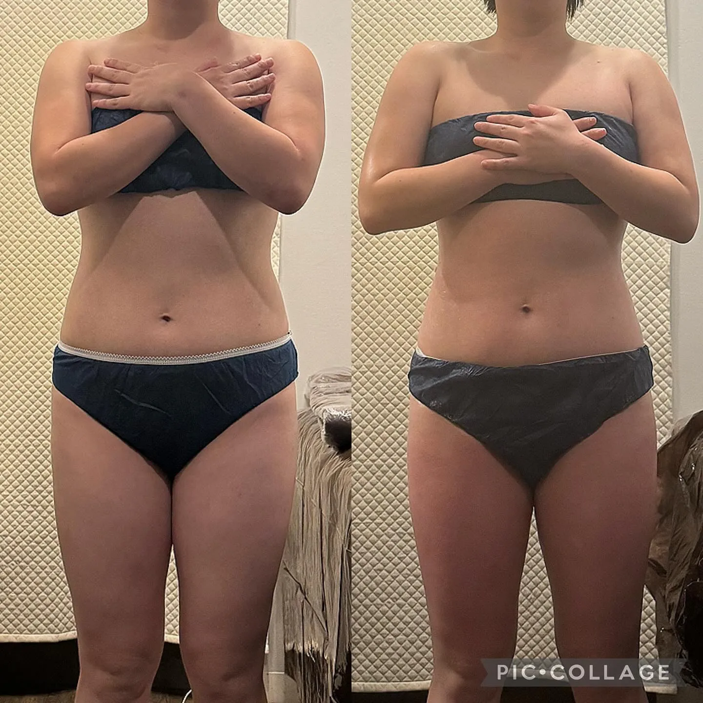 【西宮】セルゼロ全身90分コース7回目のお客様✨【エステと整...