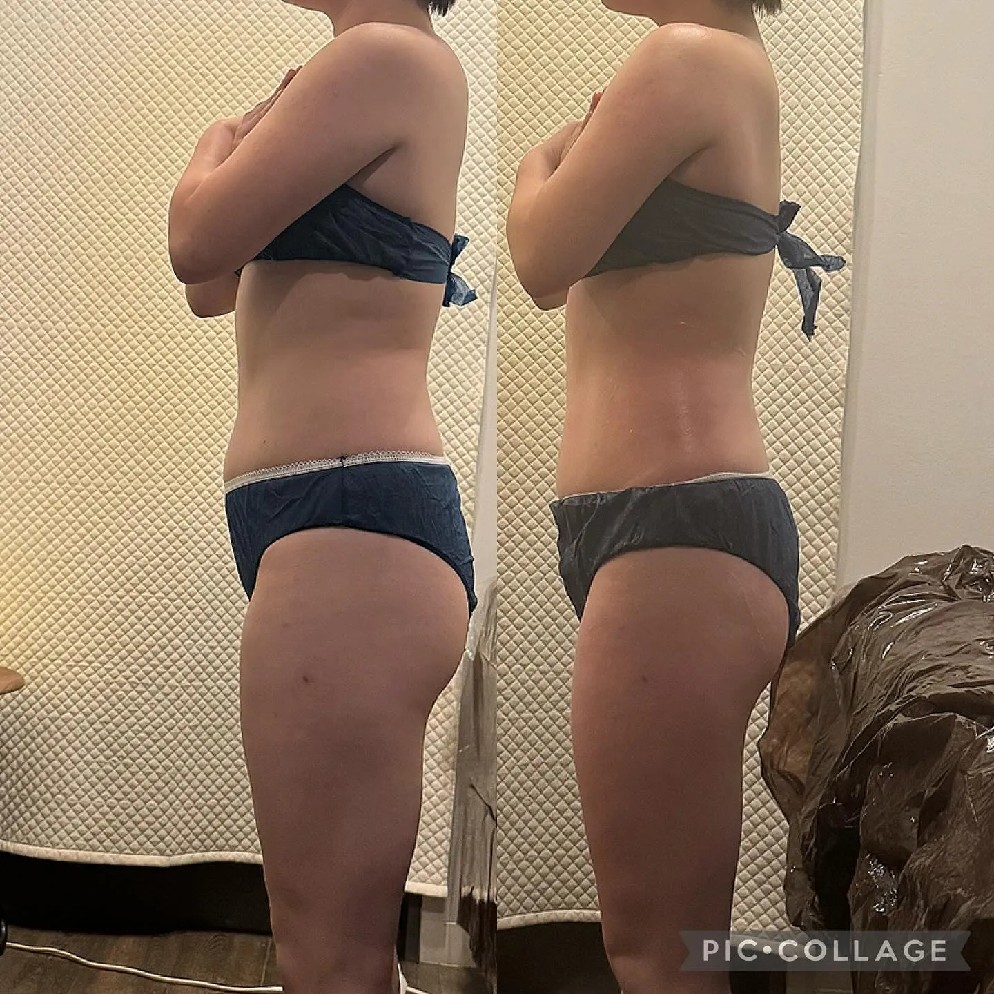 【西宮】セルゼロ全身90分コース7回目のお客様✨【エステと整...