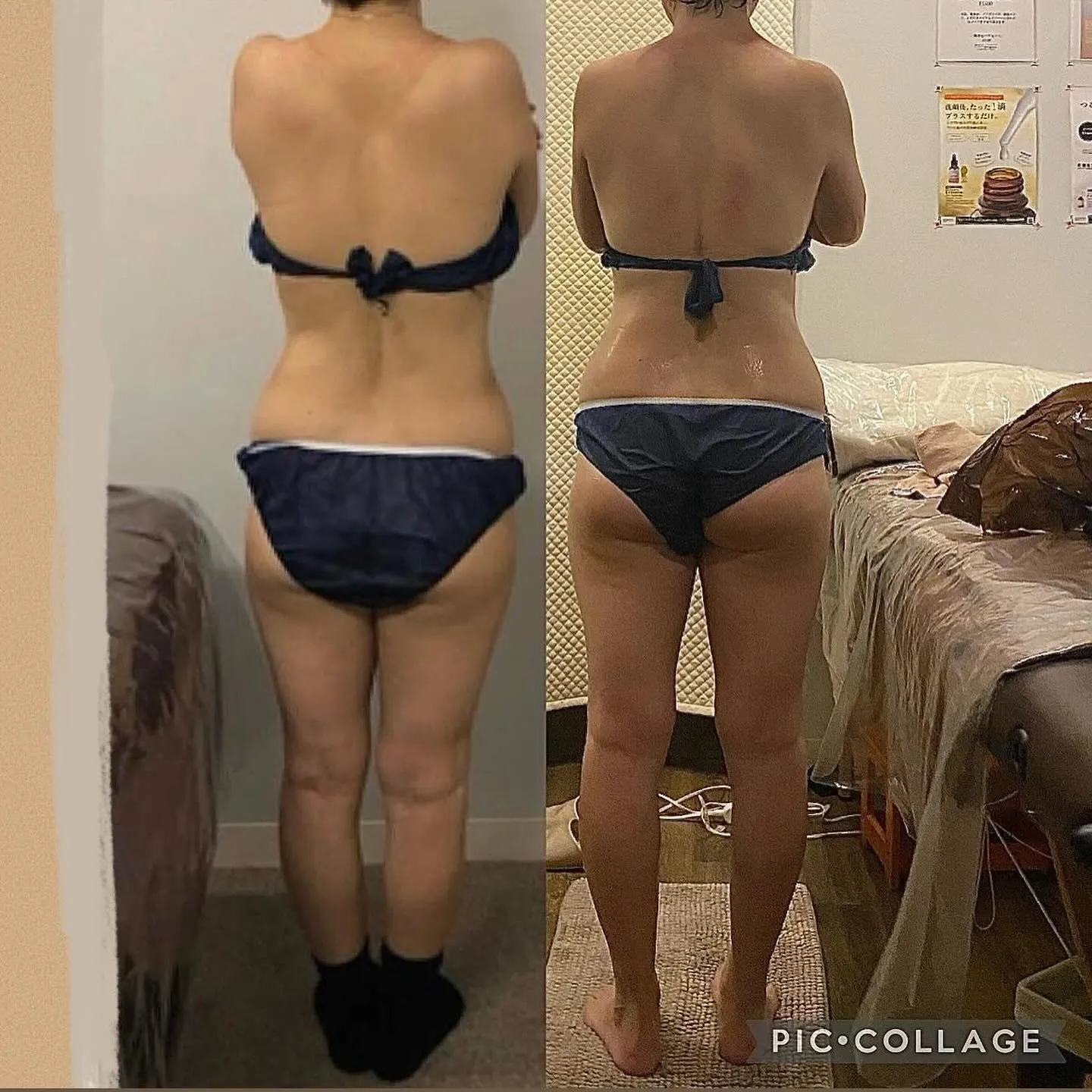 【西宮のエステ】セルゼロBefore→After✨後ろ側【セ...