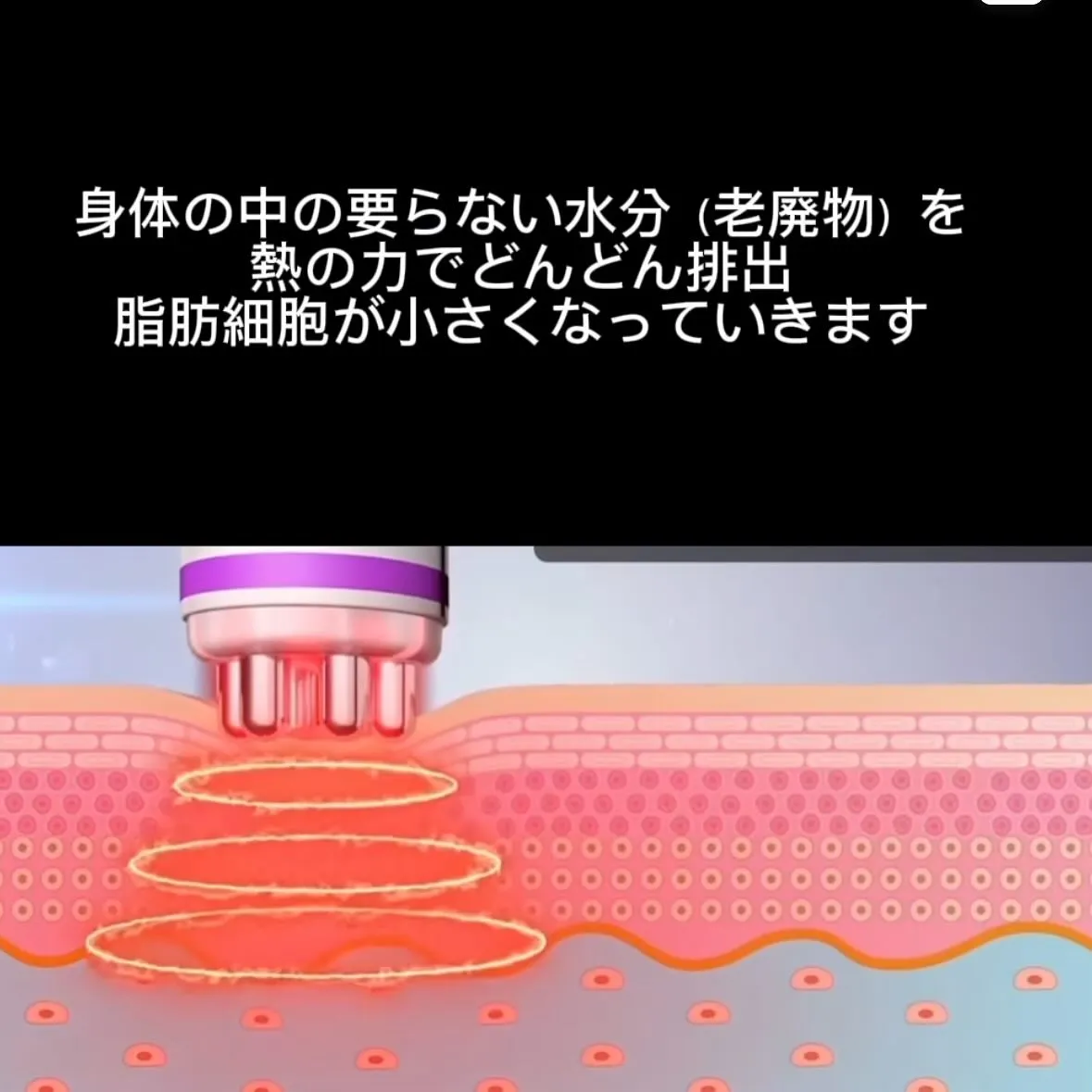 西宮の整骨院とエステ「新メニュー🧖🏻‍♀️✨二重顎やたるみを...