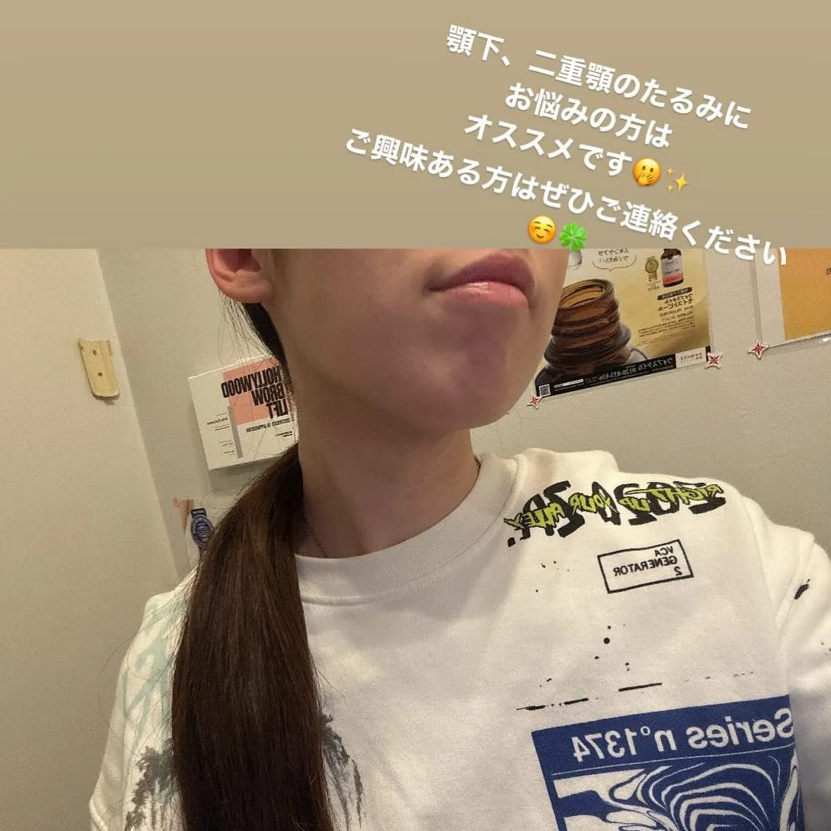 西宮の整骨院とエステ「新メニュー🧖🏻‍♀️✨二重顎やたるみを...