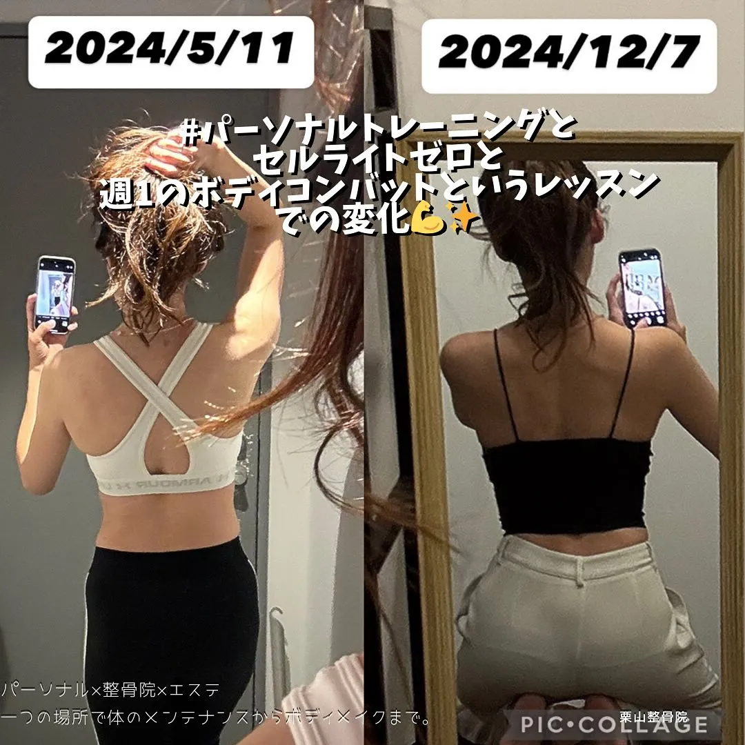 西宮でパーソナルトレーニングやセルライトゼロという痩身マシンでボディメイクやダイエットをするならBodyリカバリー栗山整骨院にお任せ💪✨