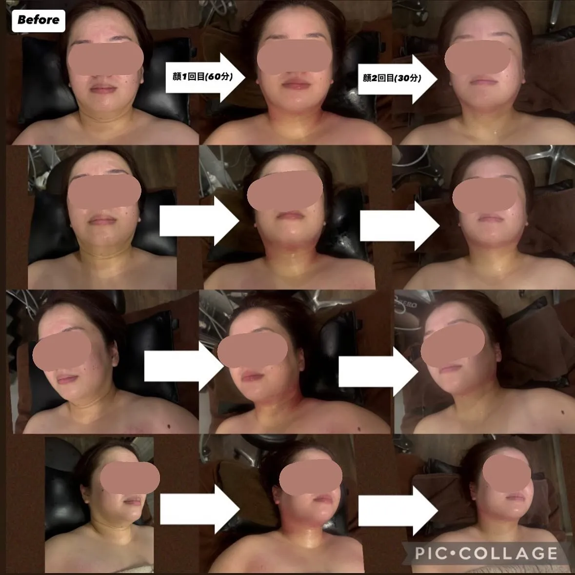 ビフォーアフター