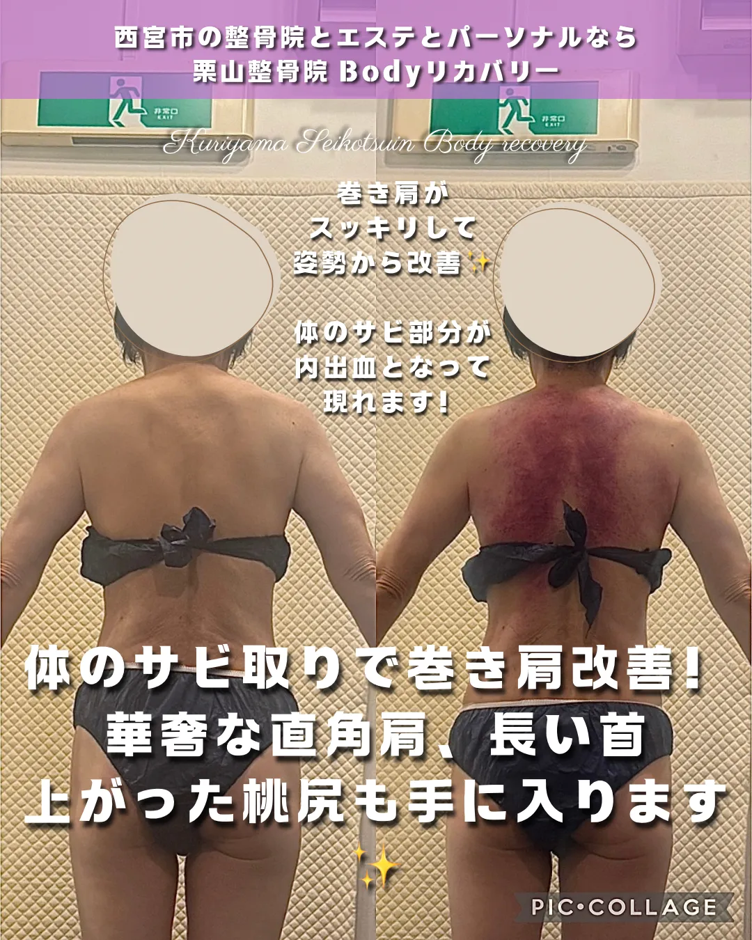 ビフォーアフター