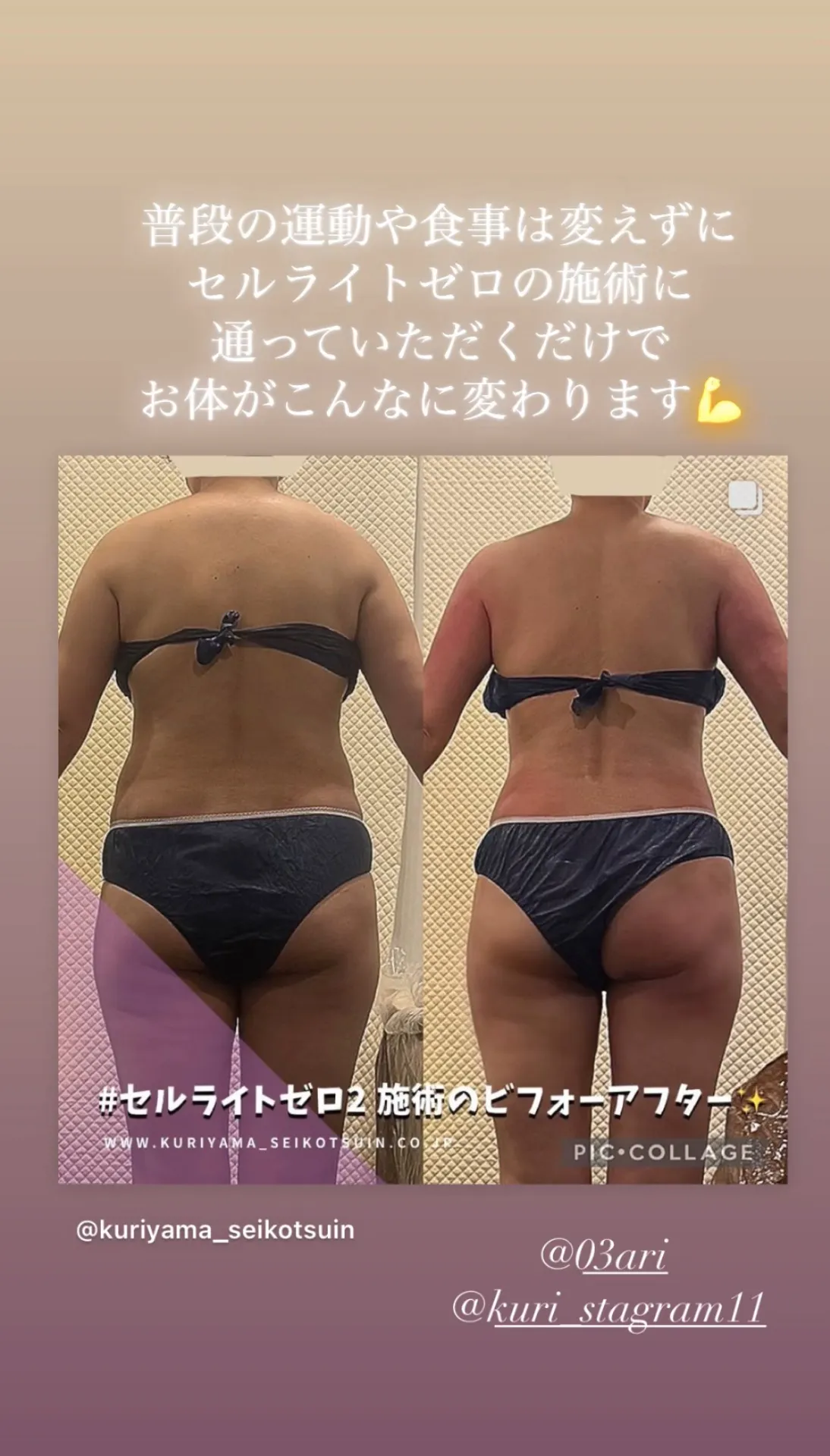 ビフォーアフター