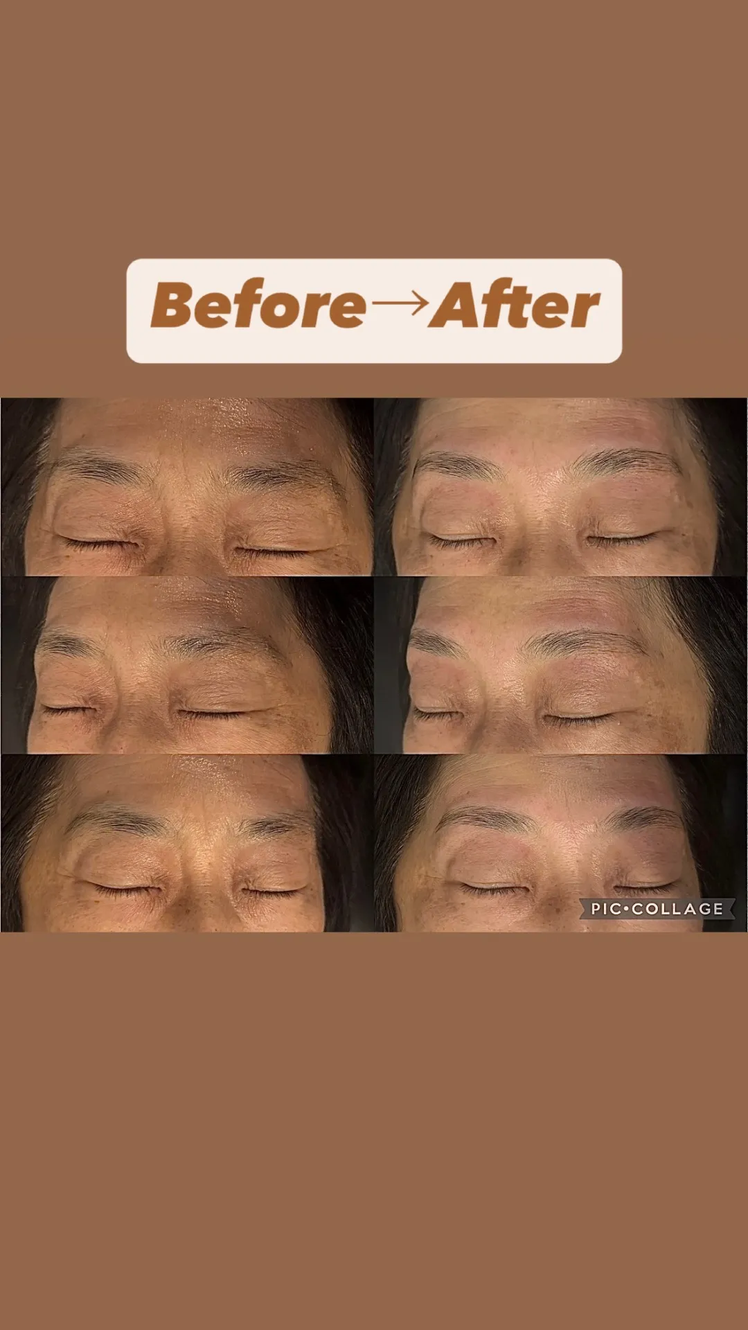 ビフォーアフター