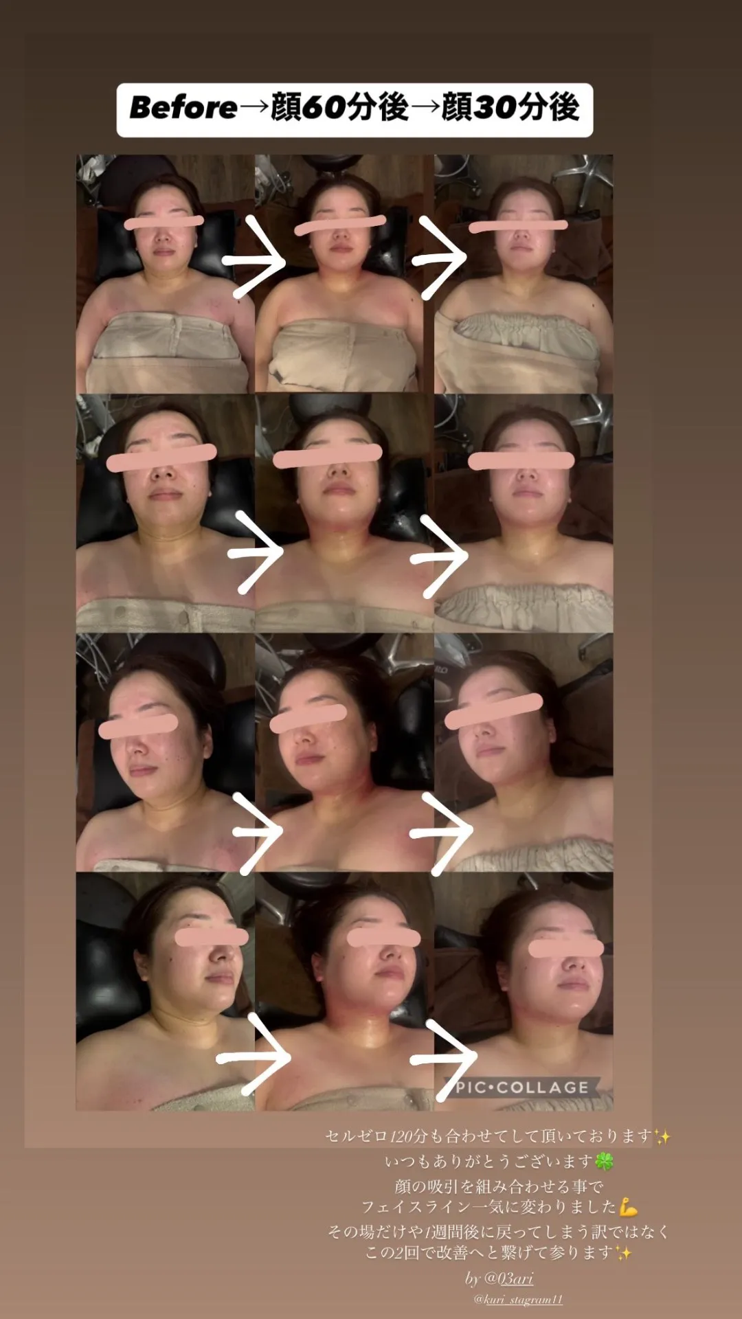 ビフォーアフター