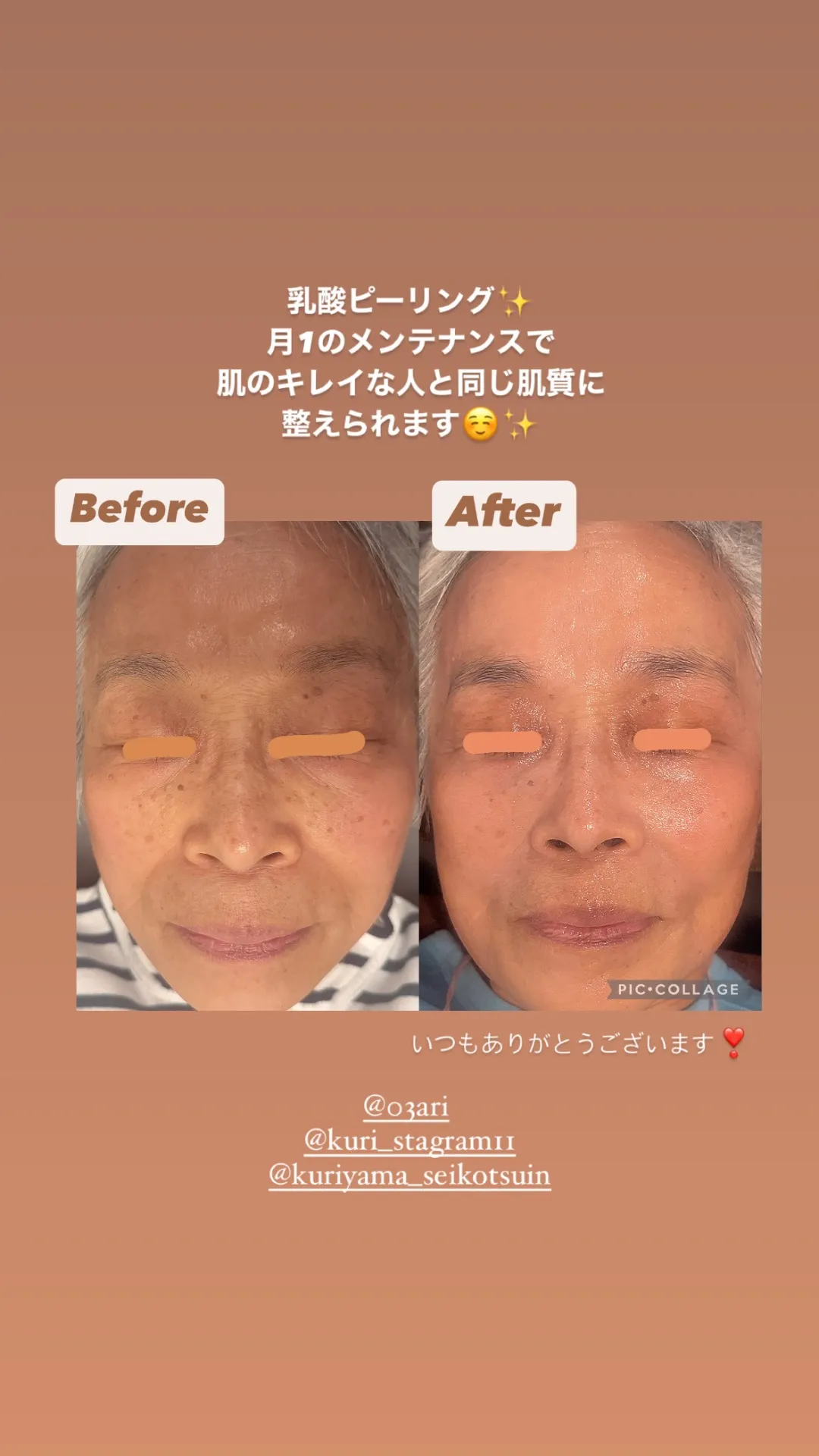 ビフォーアフター