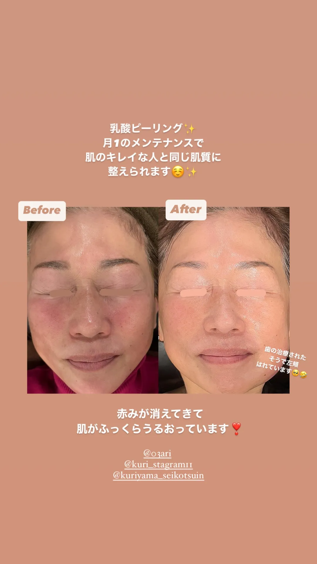 ビフォーアフター