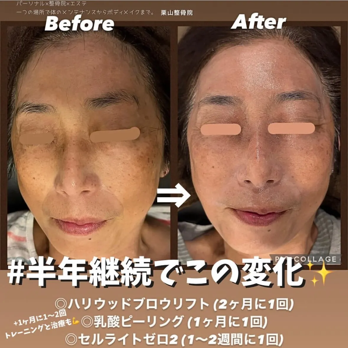 ビフォーアフター