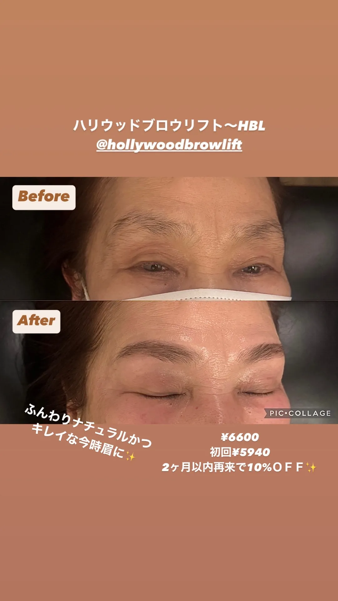 ビフォーアフター