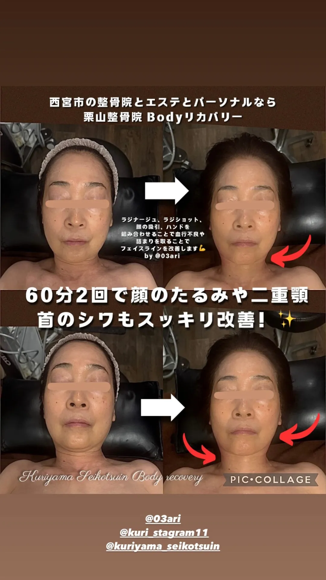 ビフォーアフター