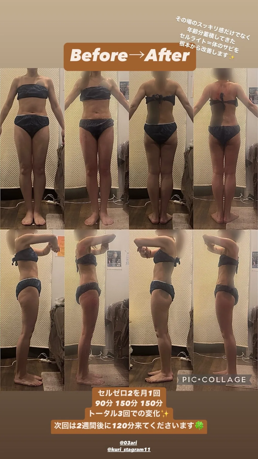 ビフォーアフター