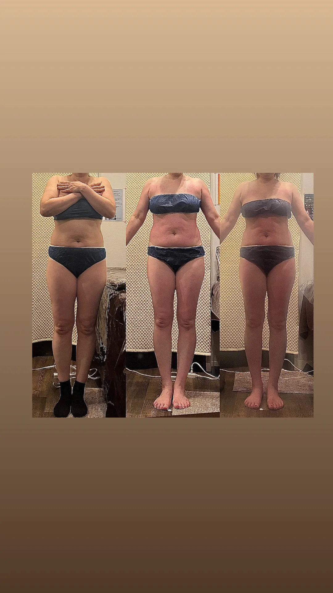 ビフォーアフター