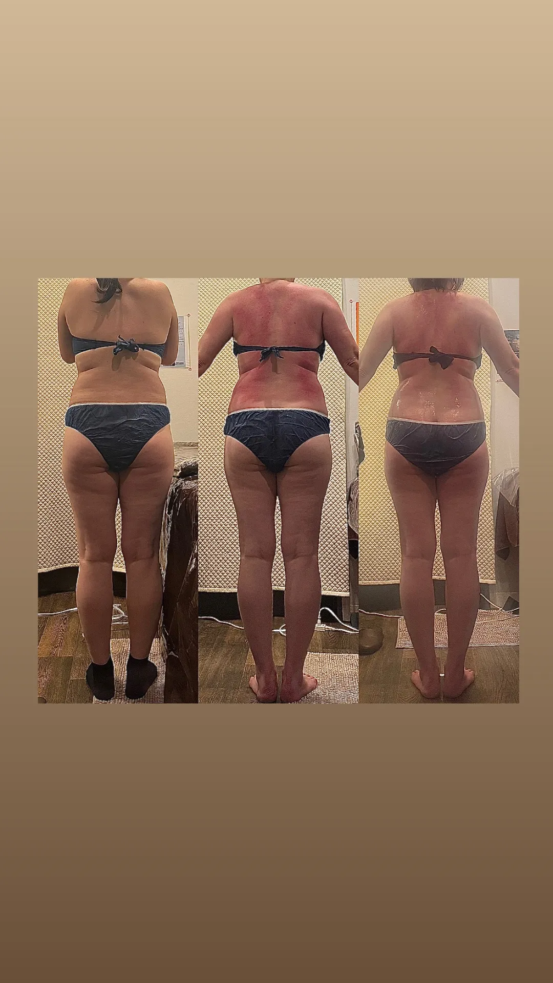 ビフォーアフター