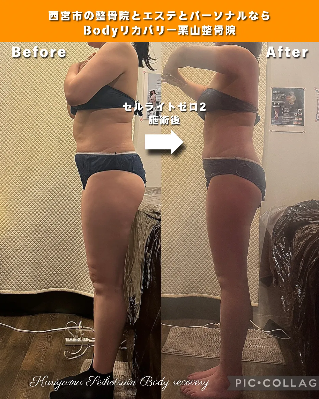 ビフォーアフター