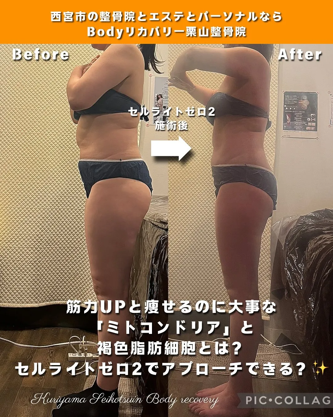 筋力UPと痩せるのに大事な「ミトコンドリア」と褐色脂肪細胞とは？セルライトゼロ2でアプローチできる？✨