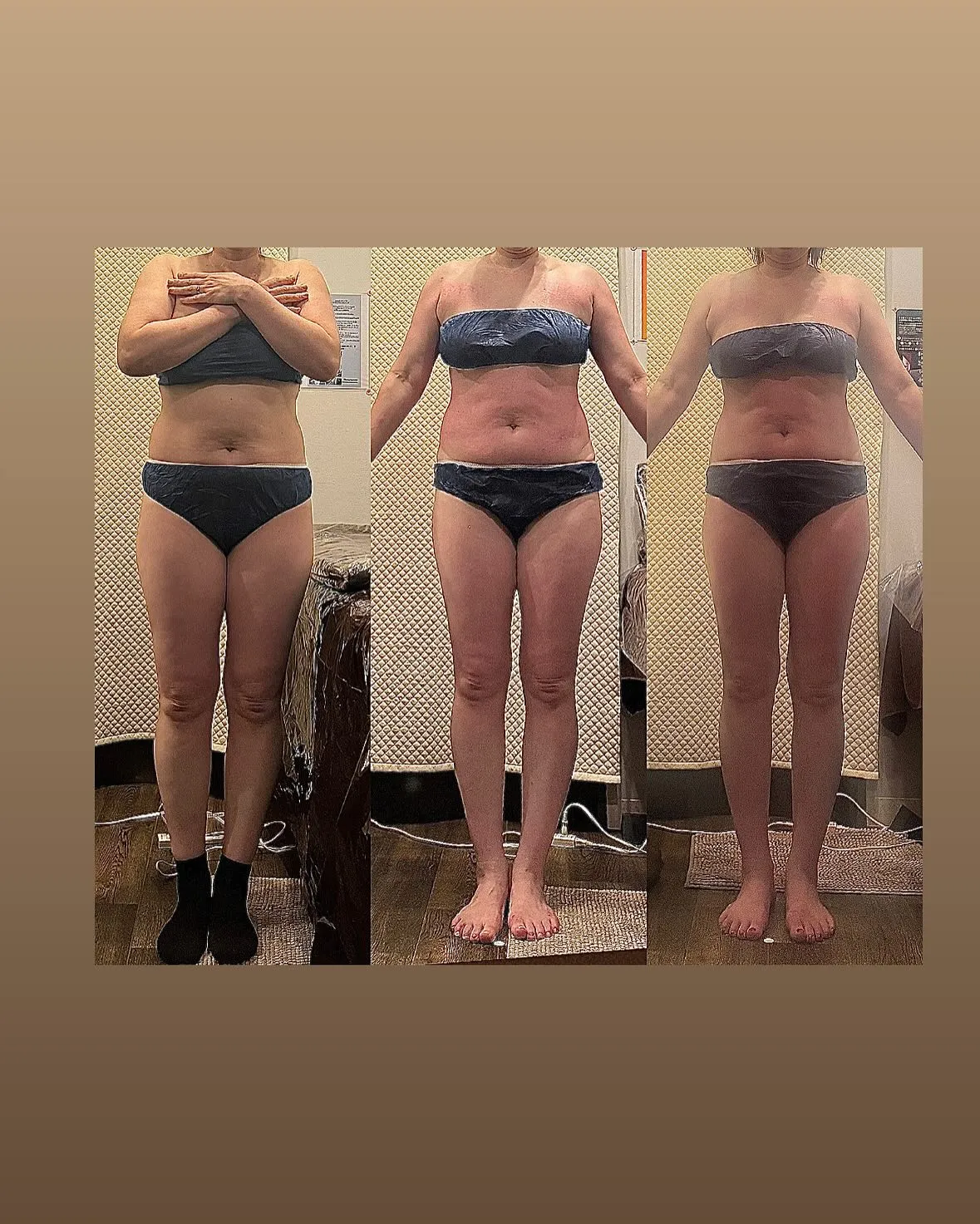 筋力UPと痩せるのに大事な「ミトコンドリア」と褐色脂肪細胞と...