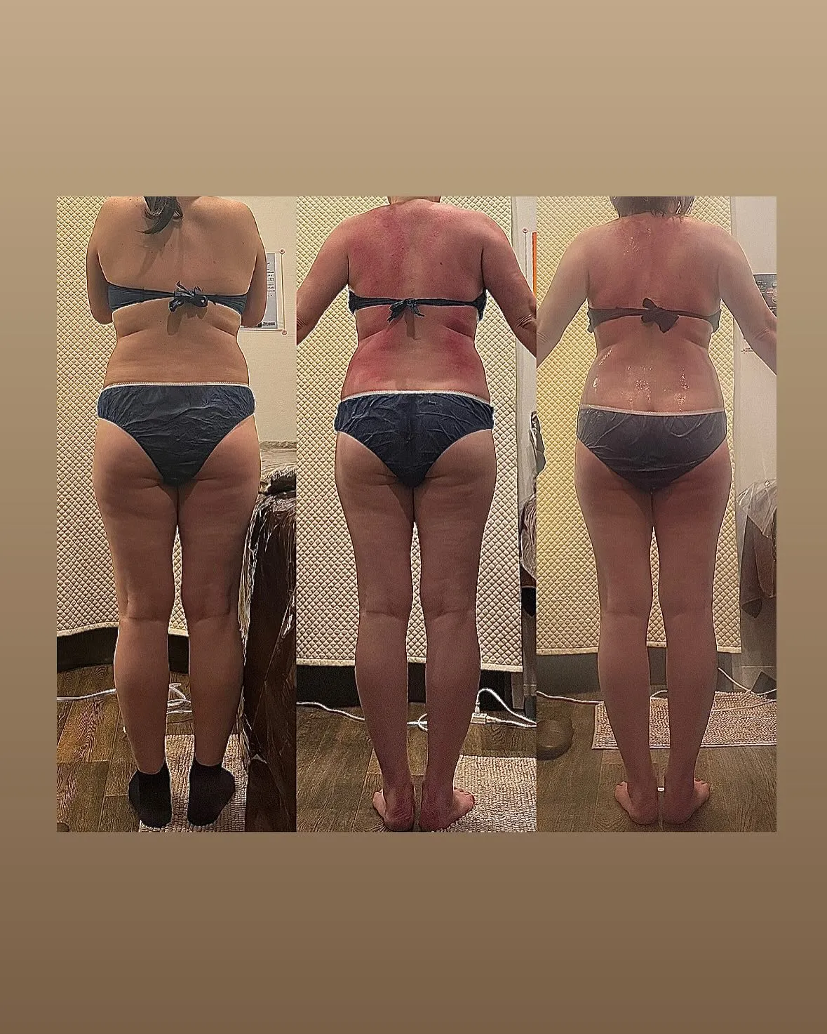 筋力UPと痩せるのに大事な「ミトコンドリア」と褐色脂肪細胞と...