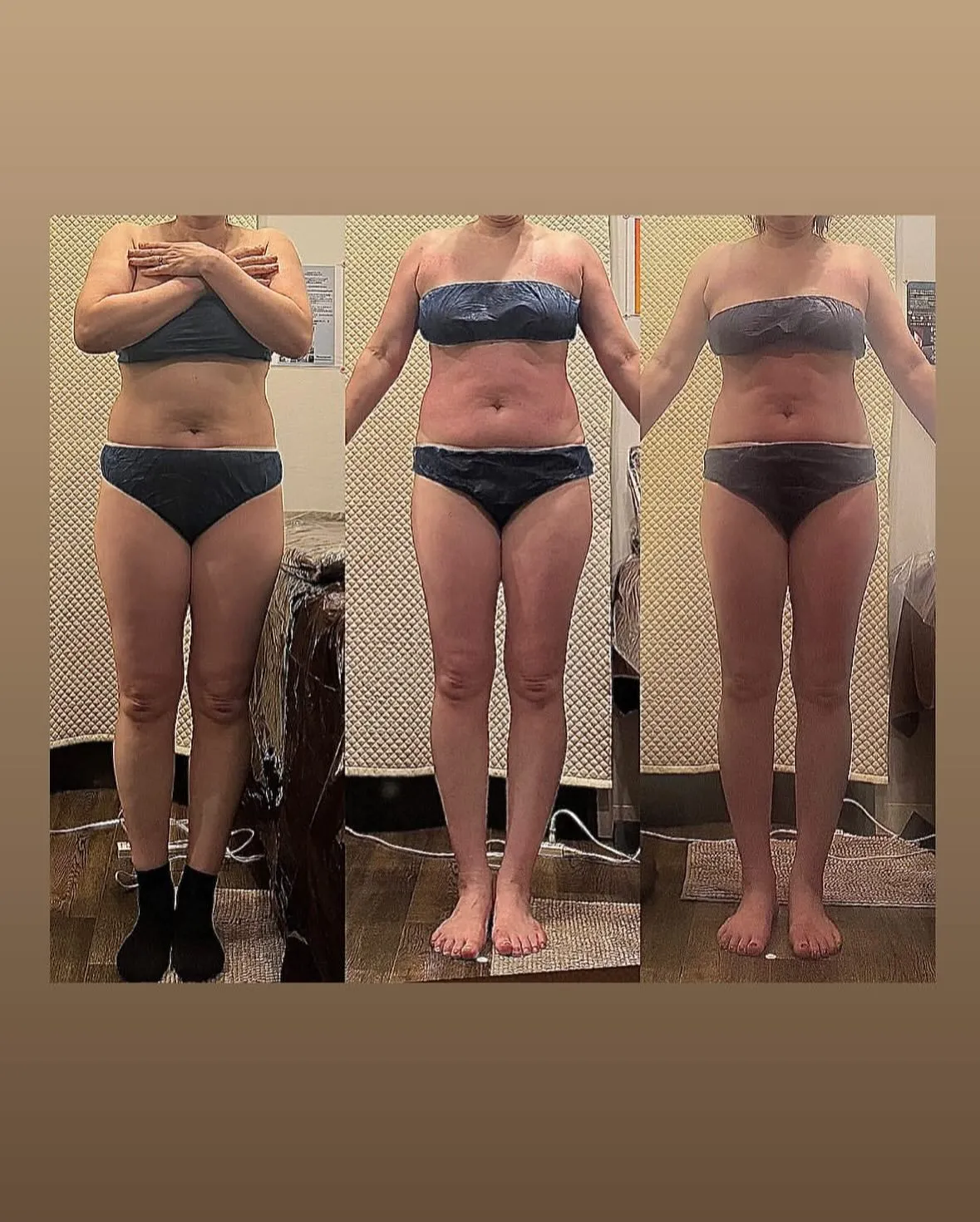 セルライトは1度落ちたらまたつくまでにどのくらいかかるの？つ...