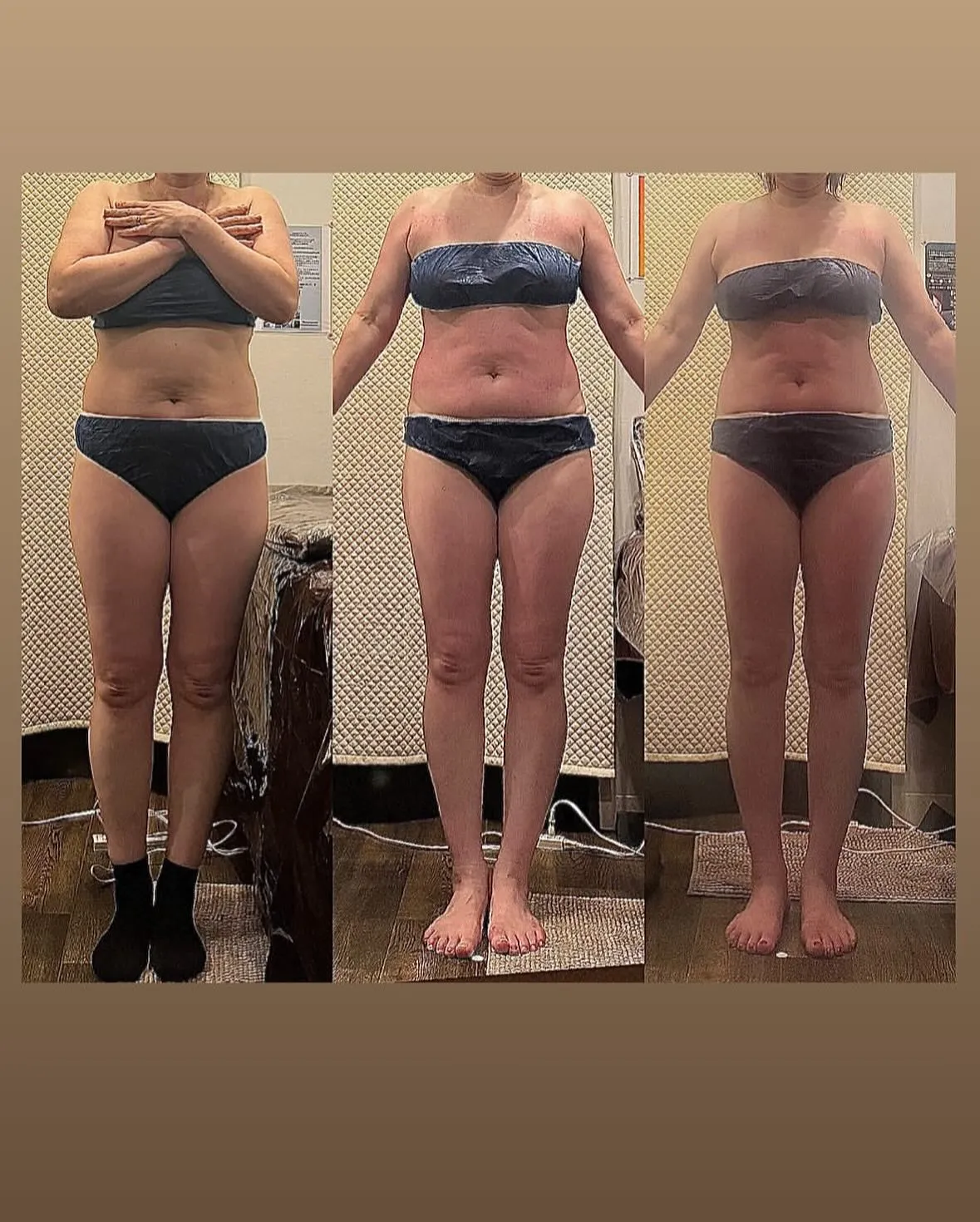 食べたものを脂肪やセルライトにしない為には何日以内に消化すれ...